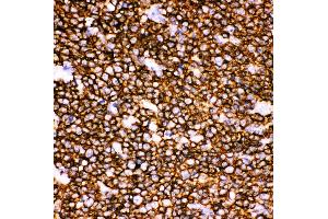 Anti-CD20 Picoband antibody,  IHC(P): Human Tonsil Tissue
