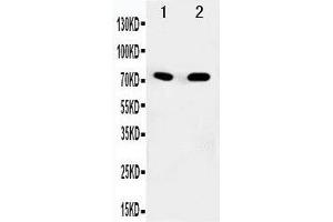 Anti-SDHA antibody, Western blotting Lane 1: Rat Heart Tissue Lysate Lane 2: COLO320 Cell Lysate (SDHA anticorps  (N-Term))