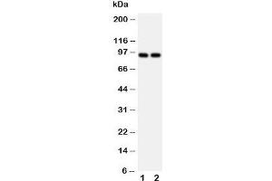 Western blot testing of MCM3 antibody and Lane 1:  HeLa;  2: Jurkat cell lysate. (MCM3 anticorps  (N-Term))