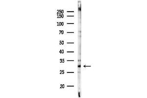 anti-Mitochondrial Translational Initiation Factor 3 (MTIF3) (C-Term) antibody
