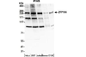 anti-Zinc Finger Protein 106 Homolog (ZFP106) (AA 1300-1350) antibody