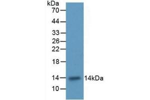 Western blot analysis of recombinant Rat ITGaM. (CD11b anticorps  (AA 598-700))