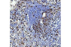 IHC analysis of CD90/Thy1 using anti-CD90/Thy1 antibody (ABIN5518877). (CD90 anticorps  (AA 20-131))
