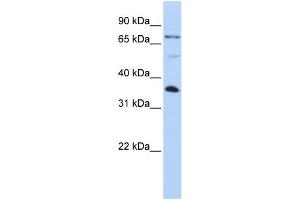 WB Suggested Anti-LASP1 Antibody Titration: 0. (LASP1 anticorps  (C-Term))