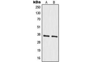 Western blot analysis of MRPS35 expression in A549 (A), HeLa (B) whole cell lysates. (MRPS35 anticorps  (Center))