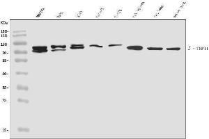 Western blot analysis of TNIP1 using anti-TNIP1 antibody (ABIN7601284).