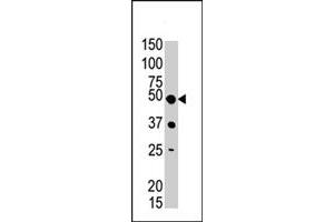 The PIGK polyclonal antibody  is used in Western blot to detect PIGK in mouse liver tissue lysate . (PIGK anticorps  (C-Term))