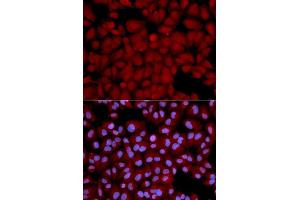 Immunofluorescence analysis of U2OS cells using PPP1CB antibody. (PPP1CB anticorps  (AA 1-327))