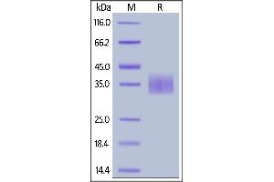 Cynomolgus Siglec-15, His Tag on  under reducing (R) condition.