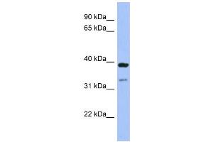 WB Suggested Anti-RASSF7 Antibody Titration:  0. (RASSF7 anticorps  (Middle Region))