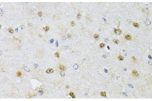 Immunohistochemistry of paraffin-embedded Rat brain using CMAS Polyclonal Antibody at dilution of 1:150 (40x lens). (CMAS anticorps)