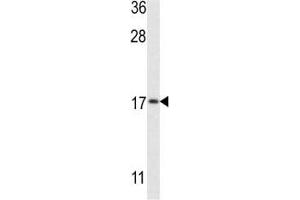 Western blot analysis of LC3II antibody and MCF-7 lysate