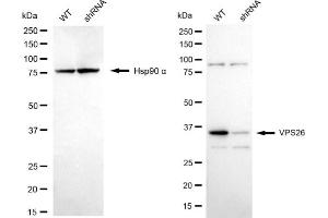 Western blotting analysis using VPS26 antibody (ABIN7800816). (Recombinant VPS26A anticorps)