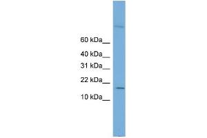 WB Suggested Anti-CST8 Antibody Titration: 0.