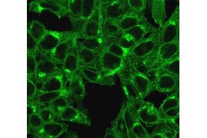 Immunofluorescent staining of HeLa cells. (beta-2 Microglobulin anticorps)