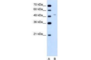 Western Blotting (WB) image for anti-Ferrochelatase (FECH) antibody (ABIN2462486) (FECH anticorps)