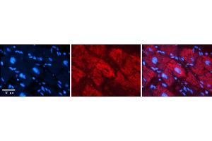 Rabbit Anti-NFATC1 Antibody    Formalin Fixed Paraffin Embedded Tissue: Human Adult heart  Observed Staining: Nuclear, Cytoplasmic Primary Antibody Concentration: 1:600 Secondary Antibody: Donkey anti-Rabbit-Cy2/3 Secondary Antibody Concentration: 1:200 Magnification: 20X Exposure Time: 0. (NFATC1 anticorps  (N-Term))