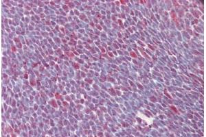 Human Thymus (formalin-fixed, paraffin-embedded) stained with SFRS1 antibody ABIN461956 at 10 ug/ml followed by biotinylated anti-mouse IgG secondary antibody ABIN481714, alkaline phosphatase-streptavidin and chromogen.