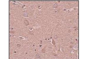 Immunohistochemistry of SRPX1 in human brain tissue with this product at 5 μg/ml. (SRPX anticorps  (N-Term))