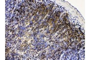IHC testing of FFPE rat lymph tissue with LYN antibody at 1ug/ml.