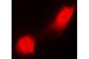 Immunofluorescent analysis of PSMC2 staining in MCF7 cells.