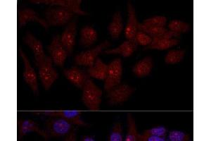 Confocal immunofluorescence analysis of Hela cells using EIF6 Polyclonal Antibody at dilution of 1:50.