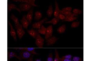 Confocal immunofluorescence analysis of Hela cells using EIF6 Polyclonal Antibody at dilution of 1:50. (EIF6 anticorps)