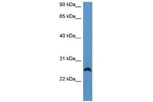 WB Suggested Anti-Frg1 Antibody Titration: 0. (FRG1 anticorps  (Middle Region))