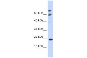 WB Suggested Anti-C21orf87 Antibody Titration:  0. (BRWD1-AS2 anticorps  (C-Term))