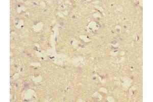 Immunohistochemistry of paraffin-embedded human brain tissue using ABIN7148480 at dilution of 1:100