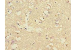Immunohistochemistry of paraffin-embedded human brain tissue using ABIN7148480 at dilution of 1:100 (CNTNAP1 anticorps  (AA 20-300))