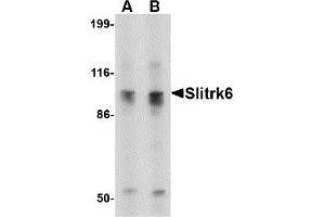Western Blotting (WB) image for anti-SLIT and NTRK-Like Family, Member 6 (SLITRK6) (C-Term) antibody (ABIN1030685)