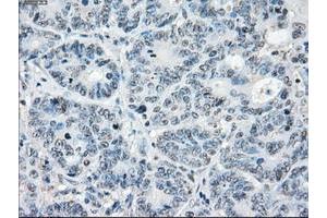 Image no. 3 for anti-Protein Phosphatase 5, Catalytic Subunit (PPP5C) antibody (ABIN1500391)