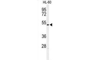 Western Blotting (WB) image for anti-Homeobox A3 (HOXA3) antibody (ABIN3004366)