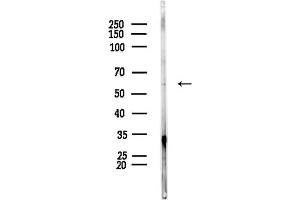 anti-Protein Phosphatase 3, Catalytic Subunit, beta Isozyme (PPP3CB) (C-Term) antibody