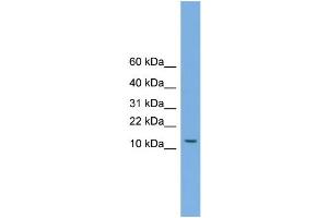 WB Suggested Anti-MAGEA5  Antibody Titration: 0. (MAGEA5 anticorps  (N-Term))