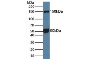 Detection of SGK1 in Mouse Brain Tissue using Polyclonal Antibody to Serum/Glucocorticoid Regulated Kinase 1 (SGK1) (SGK1 anticorps  (AA 145-386))