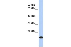 WB Suggested Anti-ARL17 Antibody Titration: 0. (ARL17 anticorps  (Middle Region))