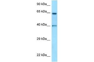 WB Suggested Anti-ANGPT1 Antibody Titration: 1. (Angiopoietin 1 anticorps  (N-Term))