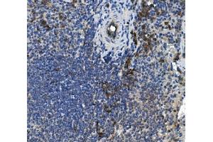 IHC analysis of PLSCR1 using anti-PLSCR1 antibody (ABIN7599471).