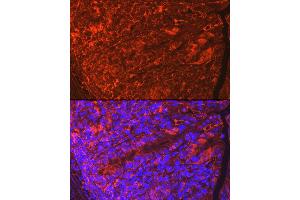 Immunofluorescence analysis of Mouse intestin using CLDN3 antibody (ABIN3017039, ABIN3017040, ABIN3017041, ABIN1679261 and ABIN6219930) at dilution of 1:100. (Claudin 3 anticorps)