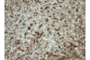 Image no. 2 for anti-Palmitoyl-Protein Thioesterase 1 (PPT1) (AA 100-306) antibody (ABIN1490802)