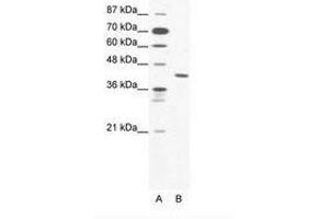 Image no. 1 for anti-Zinc Finger Protein 621 (ZNF621) (AA 208-257) antibody (ABIN203142) (ZNF621 anticorps  (AA 208-257))