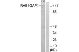Western blot analysis of extracts from 293 cells, using RAB3GAP1 Antibody. (RAB3GAP1 anticorps  (AA 538-587))