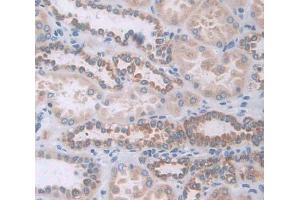 IHC-P analysis of Kidney tissue, with DAB staining. (GAA anticorps  (AA 70-225))