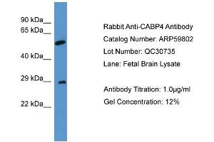 WB Suggested Anti-CABP4  Antibody Titration: 0. (CABP4 anticorps  (N-Term))