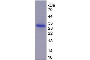 SDS-PAGE of Protein Standard from the Kit  (Highly purified E. (ADAM17 Kit ELISA)