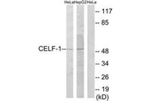 Western blot analysis of extracts from HeLa/HepG2 cells, using CELF-1 Antibody. (CELF1 anticorps  (AA 71-120))