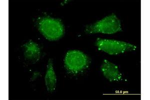 Immunofluorescence of purified MaxPab antibody to GDF3 on HeLa cell. (GDF3 anticorps  (AA 1-364))