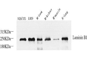 Western Blot analysis of various samples using Laminin beta1 Polyclonal Antibody at dilution of 1:800. (Laminin beta 1 anticorps)